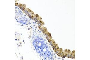 Immunohistochemistry of paraffin-embedded mouse lung using TOPBP1 antibody (ABIN6134114, ABIN6149397, ABIN6149400 and ABIN6216254) at dilution of 1:100 (40x lens). (TOPBP1 anticorps  (AA 1-100))