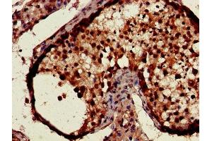 Immunohistochemistry of paraffin-embedded human testis tissue using ABIN7146852 at dilution of 1:100 (CSNK1A1 anticorps  (Isoform alpha))