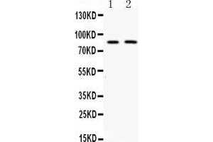 Western blot analysis of MUT expression in rat kidney extract ( Lane 1) and 22RV1 whole cell lysates ( Lane 2). (MUT anticorps  (N-Term))