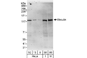 Western Blotting (WB) image for anti-Vinculin (VCL) (AA 750-800) antibody (ABIN7452915)