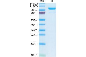 Human Complement Component C2 on Tris-Bis PAGE under reduced condition. (Complement C2 Protein (AA 21-752) (His tag))
