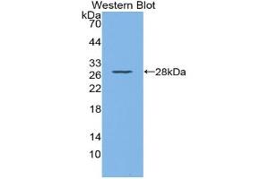 Western blot analysis of recombinant Mouse CD72. (CD72 anticorps  (AA 143-345))
