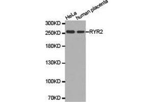 Western Blotting (WB) image for anti-Ryanodine Receptor 2 (Cardiac) (RYR2) antibody (ABIN1874679) (RYR2 anticorps)