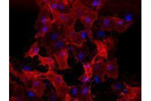 Immunofluorescence (IF) image for anti-VEGF Receptor 2 (VEGFR2) antibody (ABIN2664545) (VEGFR2/CD309 anticorps)