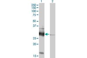 Western Blot analysis of VAPB expression in transfected 293T cell line by VAPB MaxPab polyclonal antibody. (VAPB anticorps  (AA 1-243))