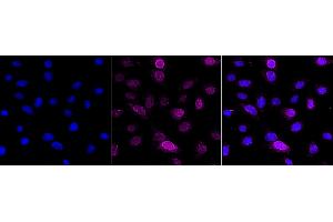 Immunocytochemical staining of C2C12 cells with PTGS2 antibody (ABIN7799939), 1:1,000).