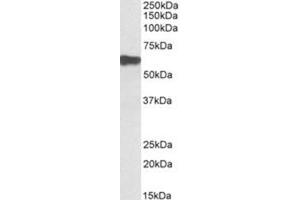 Western Blotting (WB) image for anti-Myotilin (MYOT) (AA 209-221), (Internal Region) antibody (ABIN1449481) (Myotilin anticorps  (Internal Region))