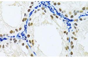 Immunohistochemistry of paraffin-embedded Rat testis using DDB1 Polyclonal Antibody at dilution of 1:100 (40x lens). (DDB1 anticorps)