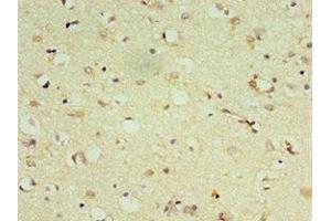 Immunohistochemistry of paraffin-embedded human brain tissue using ABIN7149474 at dilution of 1:100 (DRD3 anticorps  (AA 213-329))