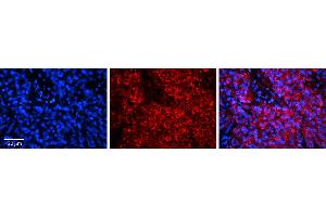 Rabbit Anti-HERC5 Antibody     Formalin Fixed Paraffin Embedded Tissue: Human Pineal Tissue  Observed Staining: Cytoplasmic in cell bodies and processes of pinealocytes  Primary Antibody Concentration: 1:100  Other Working Concentrations: 1/600  Secondary Antibody: Donkey anti-Rabbit-Cy3  Secondary Antibody Concentration: 1:200  Magnification: 20X  Exposure Time: 0.