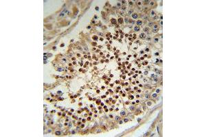 Immunohistochemistry (IHC) image for anti-Kruppel-Like Factor 5 (Intestinal) (KLF5) antibody (ABIN3003155)