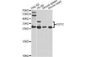 Western blot analysis of extracts of various cell lines, using GYPC antibody (ABIN5970574) at 1/1000 dilution. (CD236/GYPC anticorps)