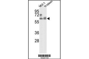 Western blot analysis of hPANK1-R90 in MCF-7 cell line and mouse spleen tissue lysates (35ug/lane)