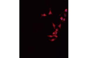 ABIN6266517 staining HeLa cells by IF/ICC. (Connexin 43/GJA1 anticorps  (Internal Region))