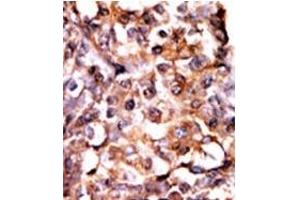 Image no. 2 for anti-Mitogen-Activated Protein Kinase-Activated Protein Kinase 2 (MAPKAPK2) (pSer272) antibody (ABIN358152) (MAPKAP Kinase 2 anticorps  (pSer272))