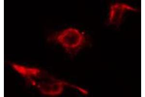 ABIN6274581 staining 293 cells by IF/ICC. (ADD2 anticorps  (Internal Region))