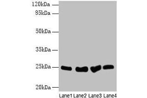 Western blot All lanes: Socs3 antibody at 12 μg/mL Lane 1: K562 whole cell lysate Lane 2: A375 whole cell lysate Lane 3: Hela whole cell lysate Lane 4: HepG2 whole cell lysate Secondary Goat polyclonal to rabbit IgG at 1/10000 dilution Predicted band size: 25 kDa Observed band size: 25 kDa (SOCS3 anticorps  (AA 1-225))