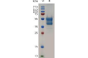 Human CD235A Protein, hFc Tag on SDS-PAGE under reducing condition.