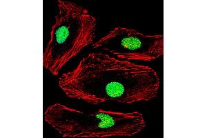 Fluorescent confocal image of Hela cell stained with MBD2 Antibody .