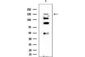Western blot analysis of lysates from COLO205 cells, using ASK1 Mouse Monoclonal Antibody at 1/1000 dilution.