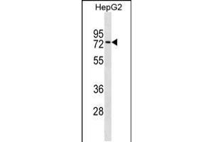 Western blot analysis in HepG2 cell line lysates (35ug/lane). (ZNF614 anticorps  (AA 174-200))
