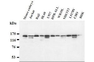 Western Blotting (WB) image for anti-Splicing Factor 3b, Subunit 1, 155kDa (SF3B1) antibody (ABIN1449178) (SF3B1 anticorps)