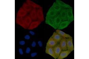 ABIN7096271 and ABIN7100333 staining Hela cells(30 min of UV treatment) by IF/ICC. (RNF145 anticorps)