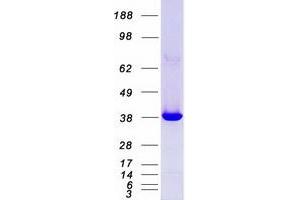 Validation with Western Blot
