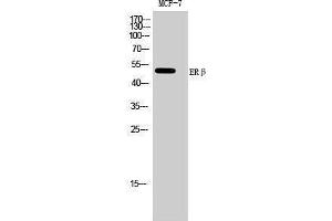 Western Blotting (WB) image for anti-Estrogen Receptor 2 (ESR2) (Ser368) antibody (ABIN3175029) (ESR2 anticorps  (Ser368))