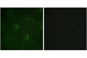 Immunofluorescence (IF) image for anti-Insulin Receptor (INSR) (AA 1326-1375) antibody (ABIN2888665)