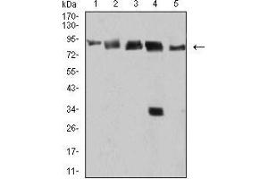 Western blot analysis using DDX1 mouse mAb against Hela (1), MCF-7 (2), A431 (3), PC-3 (4), and Jurkat (5) cell lysate. (DDX1 anticorps  (AA 642-740))