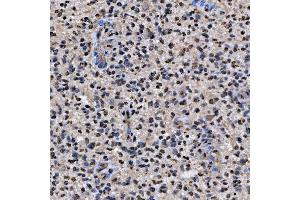 IHC analysis of SNRPA1 using anti-SNRPA1 antibody (ABIN7599131).