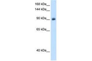 Image no. 2 for anti-Nuclear Receptor Subfamily 3, Group C, Member 2 (NR3C2) (AA 651-700) antibody (ABIN205082)