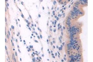 DAB staining on IHC-P; Samples: Mouse Uterus Tissue