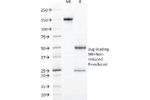 SDS-PAGE Analysis Purified StAR Mouse Monoclonal Antibody (STAR/2077).