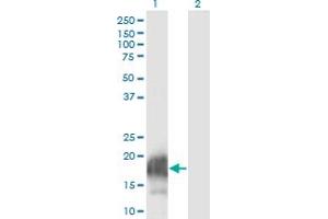 Western Blot analysis of CARHSP1 expression in transfected 293T cell line by CARHSP1 monoclonal antibody (M08), clone 4G10. (CARHSP1 anticorps  (AA 1-147))