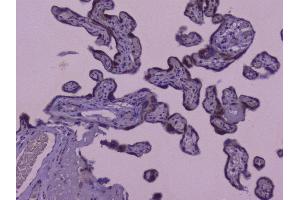 IHC analysis of CIC using anti-CIC antibody (ABIN6719536). (CIC anticorps  (AA 1433-1527))