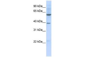 WB Suggested Anti-SLC35F3 Antibody Titration:  0. (SLC35F3 anticorps  (Middle Region))