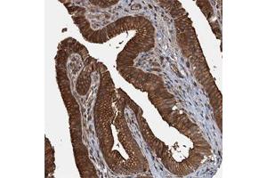 Immunohistochemical staining of human gallbladder with APOL5 polyclonal antibody  shows strong cytoplasmic and membranous positivity in glandular cells at 1:50-1:200 dilution. (Apolipoprotein L 5 anticorps)