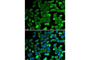 Immunofluorescence analysis of HeLa cells using SIRT2 antibody. (SIRT2 anticorps)