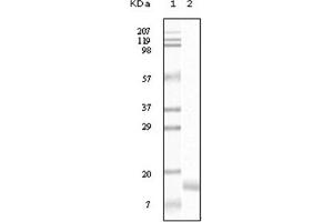 Western Blotting (WB) image for anti-Synuclein, gamma (Breast Cancer-Specific Protein 1) (SNCG) antibody (ABIN1107306) (SNCG anticorps)