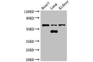 Western Blot Positive WB detected in: Mouse heart tissue, Mouse lung tissue, Mouse kidney tissue All lanes: CERK antibody at 3 μg/mL Secondary Goat polyclonal to rabbit IgG at 1/50000 dilution Predicted band size: 60, 38 kDa Observed band size: 60, 48 kDa