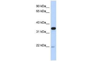 PITPNB antibody used at 1 ug/ml to detect target protein. (PITPNB anticorps  (Middle Region))