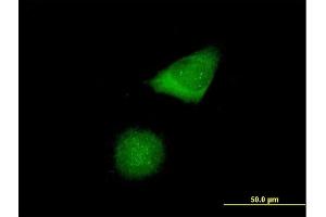 Immunofluorescence of purified MaxPab antibody to CENPH on HeLa cell. (CENPH anticorps  (AA 1-247))