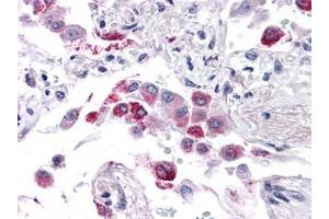 Human Lung: Formalin-Fixed, Paraffin-Embedded (FFPE) (EFHD1 anticorps  (N-Term))