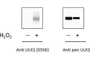 C2C12 cells were untreated or treated with 1mM H2O2 for 15 min. (ULK1 Kit ELISA)