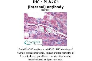 Image no. 1 for anti-Phospholipase A2, Group III (PLA2G3) (Internal Region) antibody (ABIN1738136)