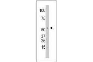 The SPPL2A polyclonal antibody  is used in Western blot to detect SPPL2A in Jurkat cell lysate. (SPPL2A anticorps  (N-Term))