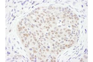 Immunohistochemistry (IHC) image for anti-Thymine-DNA Glycosylase (TDG) (AA 360-410) antibody (ABIN7455026) (TDG anticorps  (AA 360-410))