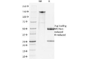 SDS-PAGE Analysis Purified PD1 Rat Monoclonal Antibody (RMP-1-14).